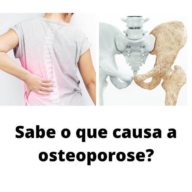 Dra. Cassiana Giribela - Osteoporose pós Menopausa